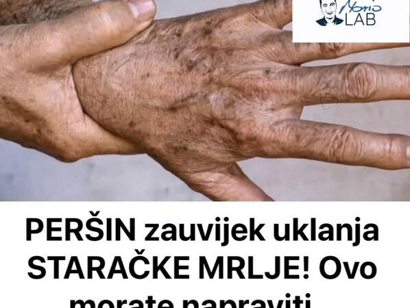 PERŠIN Zauvijek Uklanja STARAČKE MRLJE! Ovo Morate Napraviti…