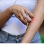 Stvarno radi: Sastojak iz doma koji učinkovito tjera komarce