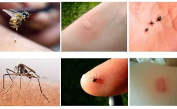 Kako se otarasiti osa, komaraca i drugih insekata uz pomoć taloga kafe (RECEPT) Kako se otarasiti osa, komaraca i drugih insekata uz pomoć taloga kafe (RECEPT)