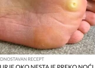 KURJE OKO NESTAJE PREKO NOĆI, STAVITE OVU BILJKU NA NJEGA KURJE OKO NESTAJE PREKO NOĆI, STAVITE OVU BILJKU NA NJEGA