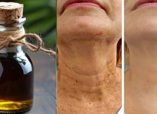 Čarobno ulje protiv starenja, ☘️ Zaglađuje sve bore na licu snažnije od botoksa Čarobno ulje protiv starenja, ☘️ Zaglađuje sve bore na licu snažnije od botoksa