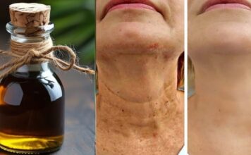 Čarobno ulje protiv starenja, ☘️ Zaglađuje sve bore na licu snažnije od botoksa Čarobno ulje protiv starenja, ☘️ Zaglađuje sve bore na licu snažnije od botoksa