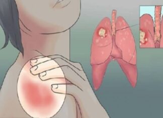 EVO KAKO MOŽETE PROVJERITI DA LI IMATE SLAB IMUNITET: 6 Znakova Lošeg Imuniteta, Ovako Tijelo Upozorava EVO KAKO MOŽETE PROVJERITI DA LI IMATE SLAB IMUNITET: 6 Znakova Lošeg Imuniteta, Ovako Tijelo Upozorava