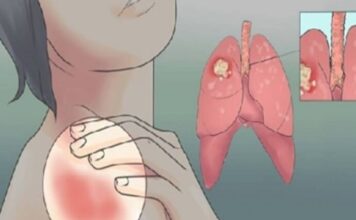 EVO KAKO MOŽETE PROVJERITI DA LI IMATE SLAB IMUNITET: 6 Znakova Lošeg Imuniteta, Ovako Tijelo Upozorava EVO KAKO MOŽETE PROVJERITI DA LI IMATE SLAB IMUNITET: 6 Znakova Lošeg Imuniteta, Ovako Tijelo Upozorava