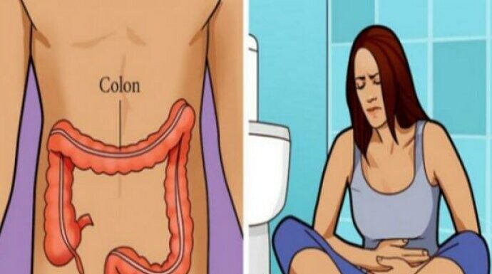 EVO KAKO PREPOZNATI RAK DEBELOG CRIJEVA NA VRIJEME: Ne čekajte ni sekund, ODMAH IDITE DOKTORU ako ovo primijetite! EVO KAKO PREPOZNATI RAK DEBELOG CRIJEVA NA VRIJEME: Ne čekajte ni sekund, ODMAH IDITE DOKTORU ako ovo primijetite!