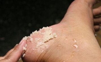 GENIJALAN RECEPT ZA GRUBE RUKE, ISPUCALE PETE, KURJE OČI I KRIVE NOKTE NA NOGAMA: Obavezno zapišite, nećete se pokajati GENIJALAN RECEPT ZA GRUBE RUKE, ISPUCALE PETE, KURJE OČI I KRIVE NOKTE NA NOGAMA: Obavezno zapišite, nećete se pokajati