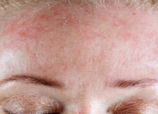 BUDITE OPREZNI! 5 znakova da se tijelo bori protiv ozbiljnog nedostatka vitamina…