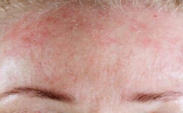 BUDITE OPREZNI! 5 znakova da se tijelo bori protiv ozbiljnog nedostatka vitamina…