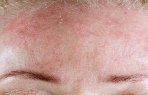 BUDITE OPREZNI! 5 znakova da se tijelo bori protiv ozbiljnog nedostatka vitamina…