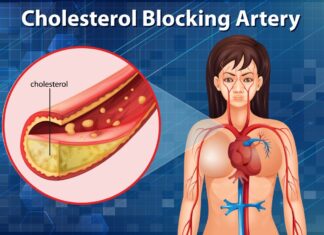 Nemoj da krkaš kao propast: Kako izbeći skokove holesterola tokom praznika i detox jelovnik Nemoj da krkaš kao propast: Kako izbeći skokove holesterola tokom praznika i detox jelovnik