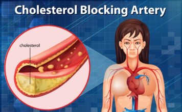 Nemoj da krkaš kao propast: Kako izbeći skokove holesterola tokom praznika i detox jelovnik Nemoj da krkaš kao propast: Kako izbeći skokove holesterola tokom praznika i detox jelovnik