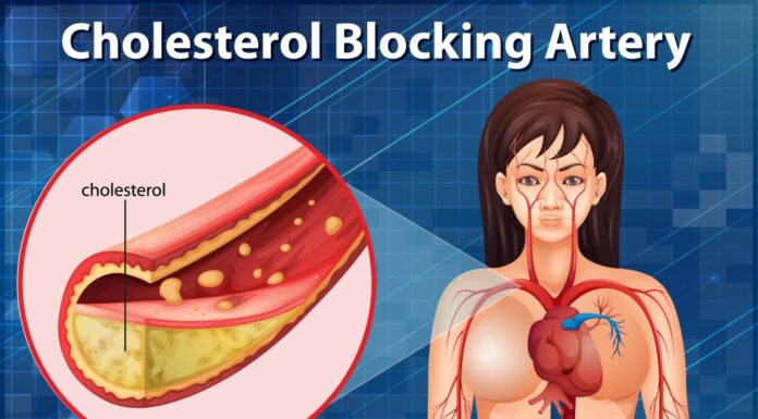 Nemoj da krkaš kao propast: Kako izbeći skokove holesterola tokom praznika i detox jelovnik Nemoj da krkaš kao propast: Kako izbeći skokove holesterola tokom praznika i detox jelovnik