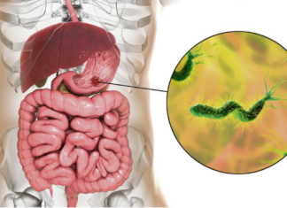 Ova bakterija je najveći neprijatelj želuca: Lako se zarazite, a posledice mogu biti opasne – obratite pažnju na 1 stvar Ova bakterija je najveći neprijatelj želuca: Lako se zarazite, a posledice mogu biti opasne – obratite pažnju na 1 stvar