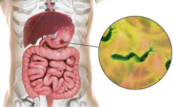 Ova bakterija je najveći neprijatelj želuca: Lako se zarazite, a posledice mogu biti opasne – obratite pažnju na 1 stvar Ova bakterija je najveći neprijatelj želuca: Lako se zarazite, a posledice mogu biti opasne – obratite pažnju na 1 stvar