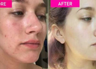 UJUTRU OBAVEZNO NAPRAVITE OVU TEČNOST I OPERITE SVOJE LICE: Izgledat ćete lijepi i mladi tokom cijelog dana! UJUTRU OBAVEZNO NAPRAVITE OVU TEČNOST I OPERITE SVOJE LICE: Izgledat ćete lijepi i mladi tokom cijelog dana!