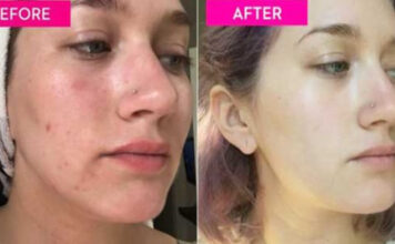 UJUTRU OBAVEZNO NAPRAVITE OVU TEČNOST I OPERITE SVOJE LICE: Izgledat ćete lijepi i mladi tokom cijelog dana! UJUTRU OBAVEZNO NAPRAVITE OVU TEČNOST I OPERITE SVOJE LICE: Izgledat ćete lijepi i mladi tokom cijelog dana!