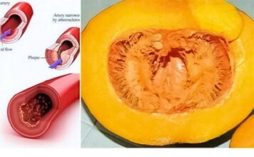 ZLATNI RECEPT: Recite zbogom povišenom holesterolu, šećeru u krvi, masnoći i trigliceridima ZLATNI RECEPT: Recite zbogom povišenom holesterolu, šećeru u krvi, masnoći i trigliceridima