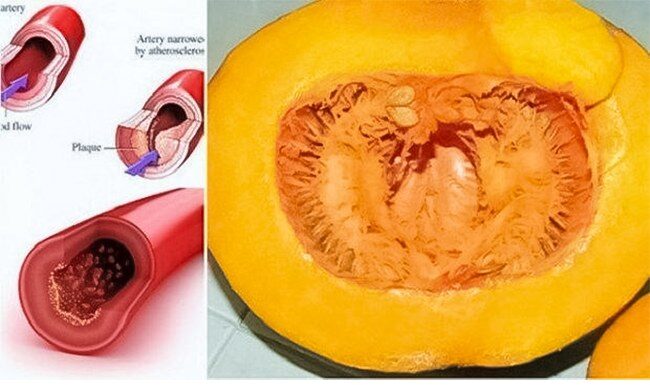 ZLATNI RECEPT: Recite zbogom povišenom holesterolu, šećeru u krvi, masnoći i trigliceridima ZLATNI RECEPT: Recite zbogom povišenom holesterolu, šećeru u krvi, masnoći i trigliceridima