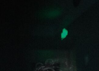 Autoimuna bitka u mišićima: Stiff-person sindrom razara živce Autoimuna bitka u mišićima: Stiff-person sindrom razara živce