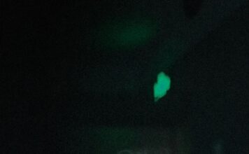 Autoimuna bitka u mišićima: Stiff-person sindrom razara živce Autoimuna bitka u mišićima: Stiff-person sindrom razara živce