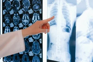 Oprez: Ovako tijelo upozorava da se stvara tromb – evo gdje sve može nastati