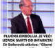 PLUĆNA EMB0LIJA JE VEĆI UZR0K SMRTI OD INFARKTA! Dr Seferović 0tkriva: “Glavni simptom se vidi na nozi”