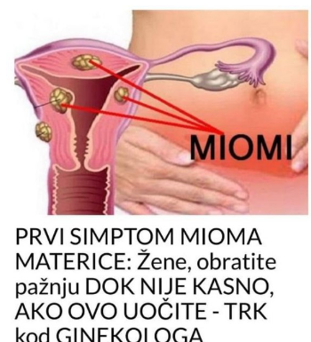 PRVI SIMPTOM MIOMA MATERICE: Žene, obratite pažnju dok nije kasno, ako ovo uočite – Trk kod ginekologa PRVI SIMPTOM MIOMA MATERICE: Žene, obratite pažnju dok nije kasno, ako ovo uočite – Trk kod ginekologa