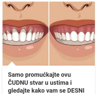 Samo Promućkajte Ovu ČUDNU Stvar U Ustima I Gledajte Kako Vam Se DESNI Za Par Dana Vraćaju U Prvobitno Stanje! Samo Promućkajte Ovu ČUDNU Stvar U Ustima I Gledajte Kako Vam Se DESNI Za Par Dana Vraćaju U Prvobitno Stanje!