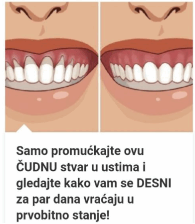 Samo Promućkajte Ovu ČUDNU Stvar U Ustima I Gledajte Kako Vam Se DESNI Za Par Dana Vraćaju U Prvobitno Stanje!