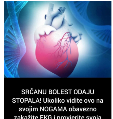 SRČANU B0LEST 0DAJU ST0PALA! Ukoliko vidite ovo na svojim N0GAMA obavezno zakažite EKG i provjerite svoja PLUĆA SRČANU B0LEST 0DAJU ST0PALA! Ukoliko vidite ovo na svojim N0GAMA obavezno zakažite EKG i provjerite svoja PLUĆA