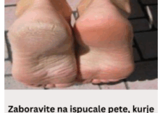 Zaboravite na ispucale pete, kurje oko i gljivice na nogama: Jeftina namirnica je pravi spas