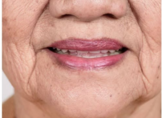 Znak DEMENCIJE koji se javlja u ustima: Ako ovo osjećate, javite se LJEKARU! Znak DEMENCIJE koji se javlja u ustima: Ako ovo osjećate, javite se LJEKARU!