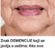 Znak DEMENCIJE koji se javlja u ustima: Ako ovo osjećate, javite se LJEKARU!