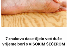 7 znakova da se tijelo već duže vrijeme bori s VISOKIM ŠEĆEROM UKRVI: Prvo ćete to primijetiti na očima i nogama!