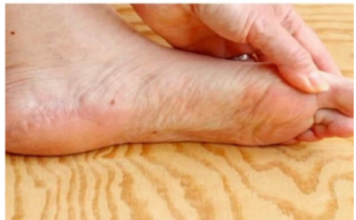 7 znakova da se tijelo već duže vrijeme bori s VISOKIM ŠEĆEROM UKRVI: Prvo ćete to primijetiti na očima i nogama! 7 znakova da se tijelo već duže vrijeme bori s VISOKIM ŠEĆEROM UKRVI: Prvo ćete to primijetiti na očima i nogama!