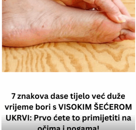 7 znakova da se tijelo već duže vrijeme bori s VISOKIM ŠEĆEROM UKRVI: Prvo ćete to primijetiti na očima i nogama!