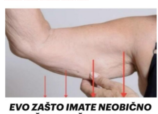 EVO ZAŠTO IMATE NEOBIČNO OBJEŠENU KOŽU- Većina ljudi nema pojma o ovom problemu. Jedino efikasno rješenje je ovaj domaći trik EVO ZAŠTO IMATE NEOBIČNO OBJEŠENU KOŽU- Većina ljudi nema pojma o ovom problemu. Jedino efikasno rješenje je ovaj domaći trik