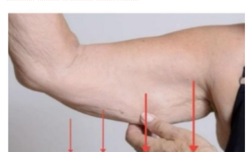 EVO ZAŠTO IMATE NEOBIČNO OBJEŠENU KOŽU- Većina ljudi nema pojma o ovom problemu. Jedino efikasno rješenje je ovaj domaći trik EVO ZAŠTO IMATE NEOBIČNO OBJEŠENU KOŽU- Većina ljudi nema pojma o ovom problemu. Jedino efikasno rješenje je ovaj domaći trik