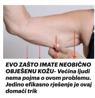 EVO ZAŠTO IMATE NEOBIČNO OBJEŠENU KOŽU- Većina ljudi nema pojma o ovom problemu. Jedino efikasno rješenje je ovaj domaći trik