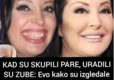 KAD SU SKUPILI PARE, URADILI SU ZUBE: POGLEDAJTE kako su izgledale domaće ličnosti PRIJE UMJETNIH ZUBA – CECA JE HIT (FOTO)