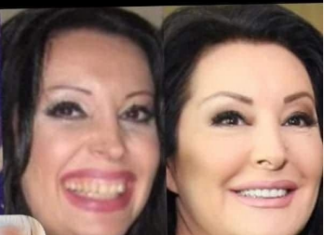 KAD SU SKUPILI PARE, URADILI SU ZUBE: POGLEDAJTE kako su izgledale domaće ličnosti PRIJE UMJETNIH ZUBA – CECA JE HIT (FOTO) KAD SU SKUPILI PARE, URADILI SU ZUBE: POGLEDAJTE kako su izgledale domaće ličnosti PRIJE UMJETNIH ZUBA – CECA JE HIT (FOTO)