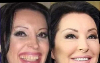 KAD SU SKUPILI PARE, URADILI SU ZUBE: POGLEDAJTE kako su izgledale domaće ličnosti PRIJE UMJETNIH ZUBA – CECA JE HIT (FOTO) KAD SU SKUPILI PARE, URADILI SU ZUBE: POGLEDAJTE kako su izgledale domaće ličnosti PRIJE UMJETNIH ZUBA – CECA JE HIT (FOTO)