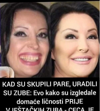 KAD SU SKUPILI PARE, URADILI SU ZUBE: POGLEDAJTE kako su izgledale domaće ličnosti PRIJE UMJETNIH ZUBA – CECA JE HIT (FOTO) KAD SU SKUPILI PARE, URADILI SU ZUBE: POGLEDAJTE kako su izgledale domaće ličnosti PRIJE UMJETNIH ZUBA – CECA JE HIT (FOTO)