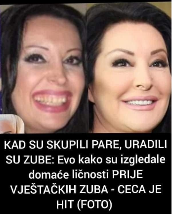 KAD SU SKUPILI PARE, URADILI SU ZUBE: POGLEDAJTE kako su izgledale domaće ličnosti PRIJE UMJETNIH ZUBA – CECA JE HIT (FOTO)