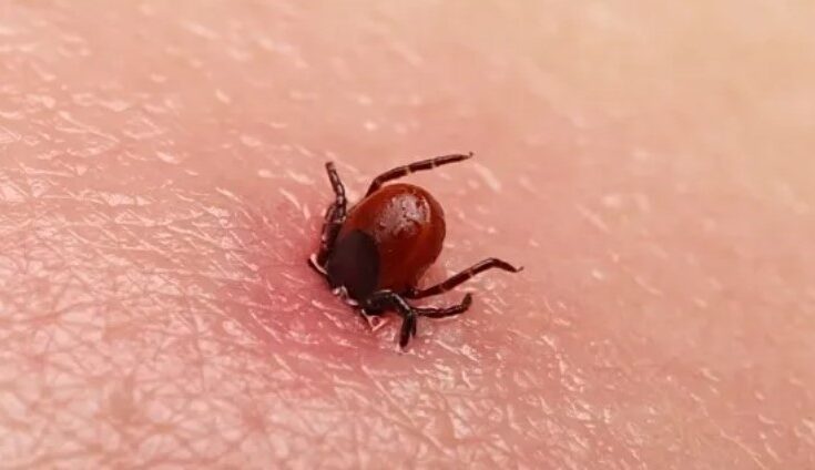 Kako izvaditi krpelja ako ste daleko od ambulante