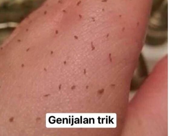MITISERI SAMI ISPADAJU IZ PORA, ŽENA POKAZALA GENIJALAN TRIK: Uradite ove 3 stvari i oduševit ćete se licem (FOTO)