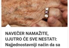 NAVEČER NAMAŽITE, UJUTRO ĆE SVE NESTATI: Najjednostavniji način da sa ruku uklonite fleke i staračke pjege