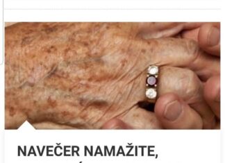 NAVEČER NAMAŽITE, UJUTRO ĆE SVE NESTATI: Najjednostavniji način da sa ruku uklonite fleke i staračke pjege NAVEČER NAMAŽITE, UJUTRO ĆE SVE NESTATI: Najjednostavniji način da sa ruku uklonite fleke i staračke pjege