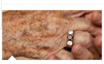 NAVEČER NAMAŽITE, UJUTRO ĆE SVE NESTATI: Najjednostavniji način da sa ruku uklonite fleke i staračke pjege NAVEČER NAMAŽITE, UJUTRO ĆE SVE NESTATI: Najjednostavniji način da sa ruku uklonite fleke i staračke pjege