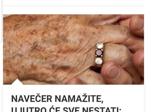 NAVEČER NAMAŽITE, UJUTRO ĆE SVE NESTATI: Najjednostavniji način da sa ruku uklonite fleke i staračke pjege NAVEČER NAMAŽITE, UJUTRO ĆE SVE NESTATI: Najjednostavniji način da sa ruku uklonite fleke i staračke pjege